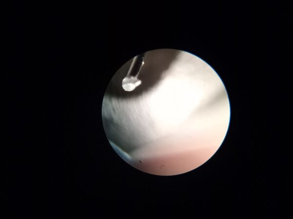 WhatsApp Image 2026-05-04 at 18.00.57 Ortofon MC Anna (Usada)